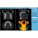 Promax 3D Plus Promax 3D Plus